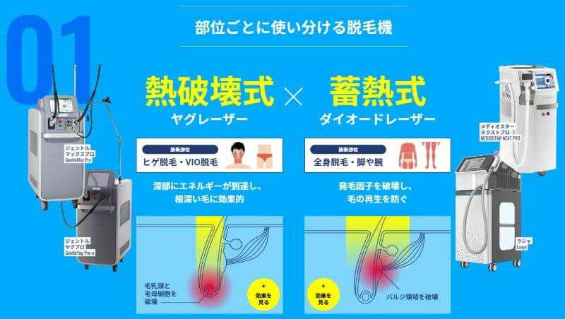 メンズリゼのヒゲ・VIOはジェントルマックスプロ