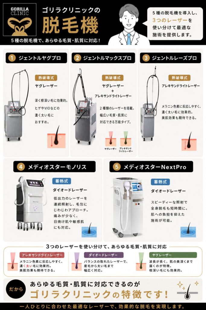 ゴリラクリニックの脱毛機