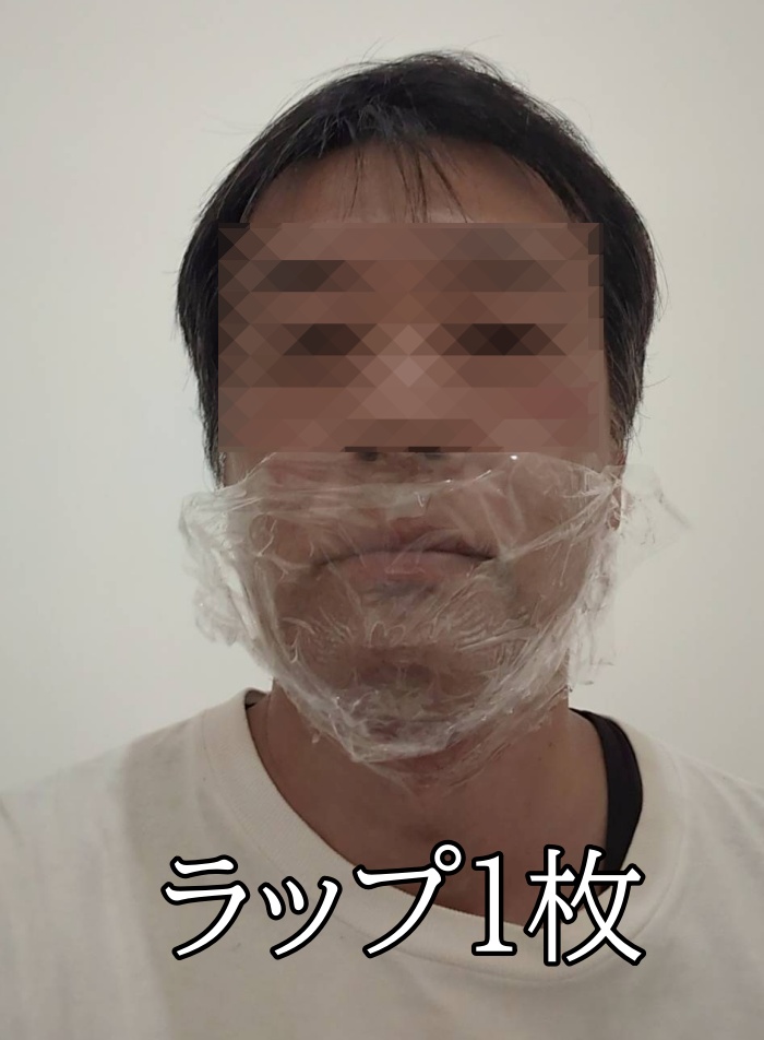 メンズエミナル麻酔をラップ1枚で覆う