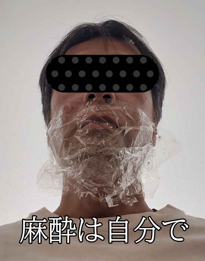 メンズエミナルの麻酔は自分で