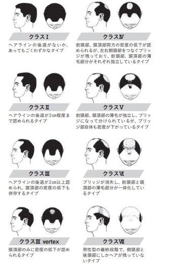 ハミルトン・ノーウッド分類
