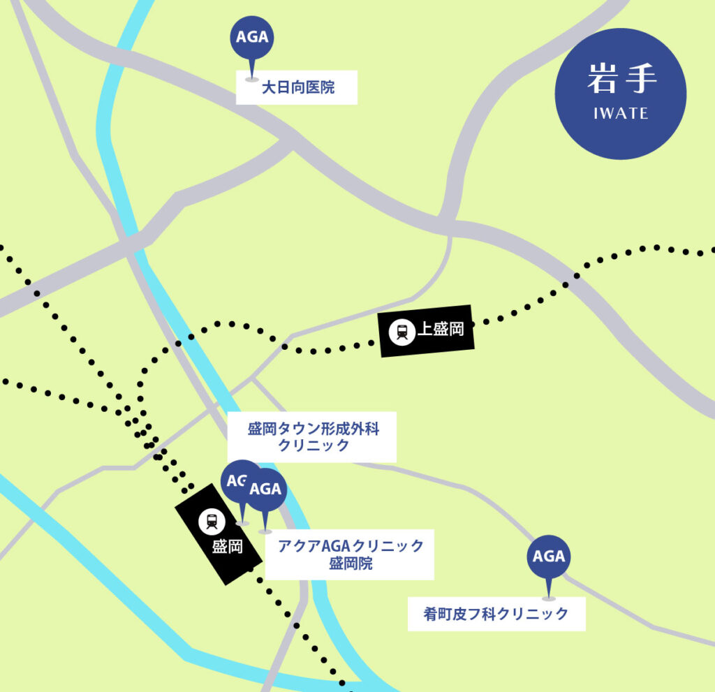 岩手のAGA治療が安いクリニックマップ