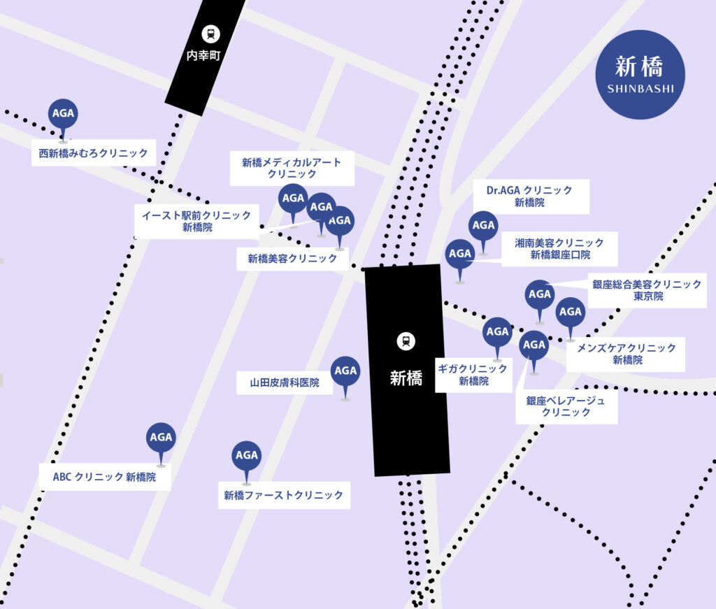 新橋AGA治療が安いクリニックマップ