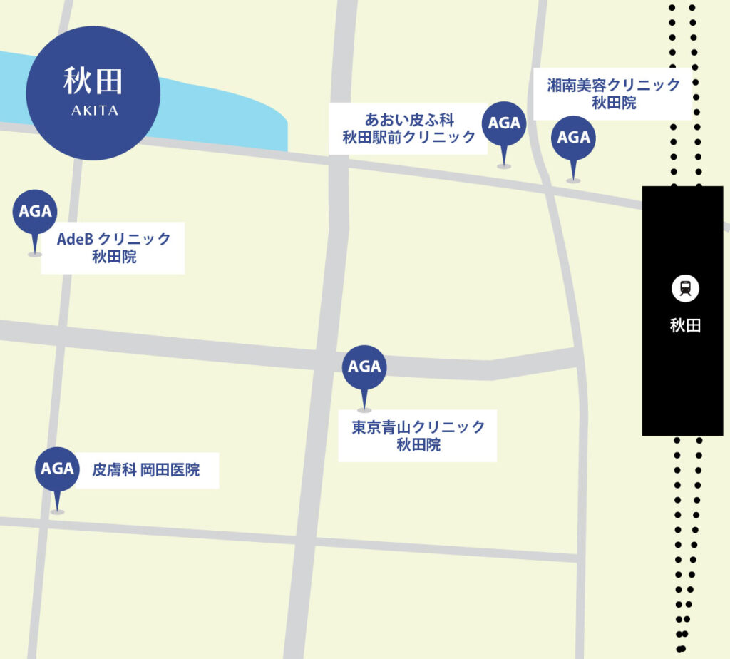 秋田のAGA治療が安いクリニックマップ