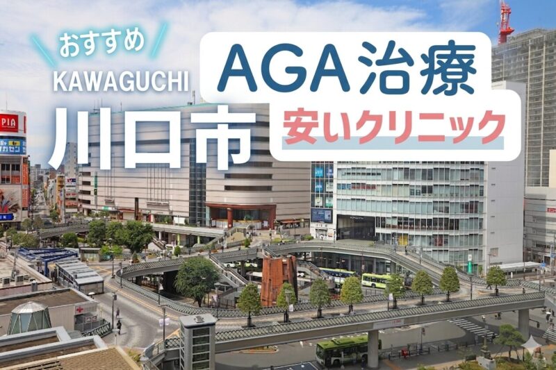 川口AGA安いクリニックおすすめ