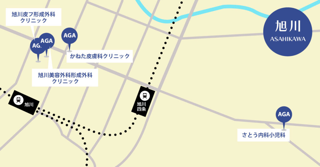 旭川のAGA治療が安いクリニックマップ