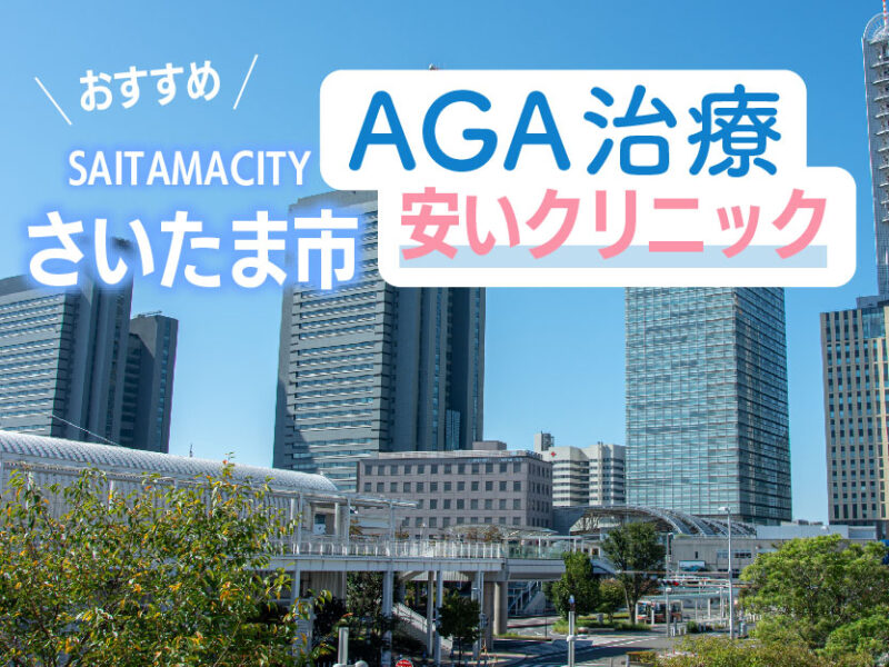 さいたま市AGA安いクリニックおすすめ