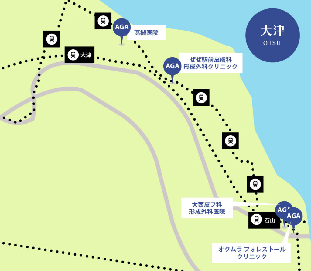 大津のAGA治療が安いクリニックマップ