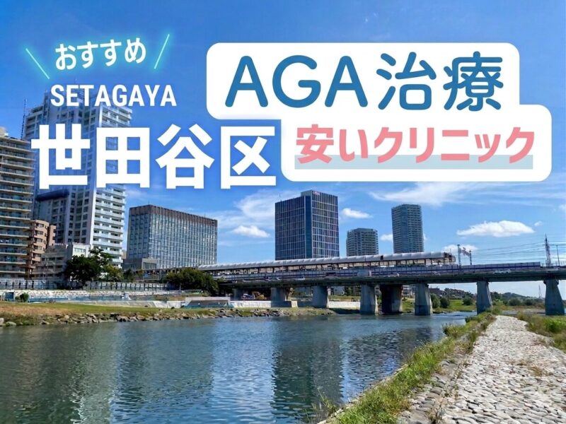 世田谷区AGA安いクリニックおすすめ