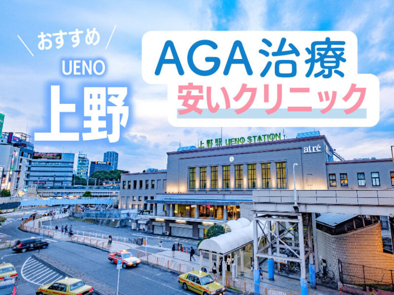 上野AGA安いクリニックおすすめ
