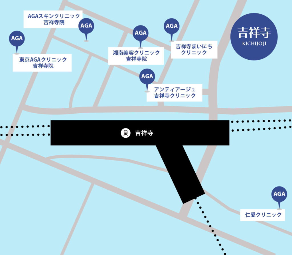 吉祥寺のAGA治療が安いクリニックマップ