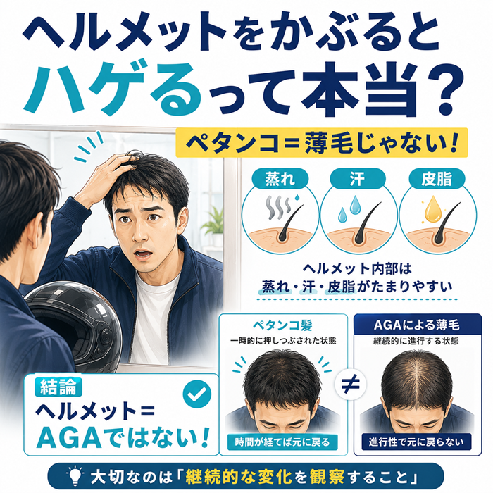 ヘルメットをかぶるとハゲる？