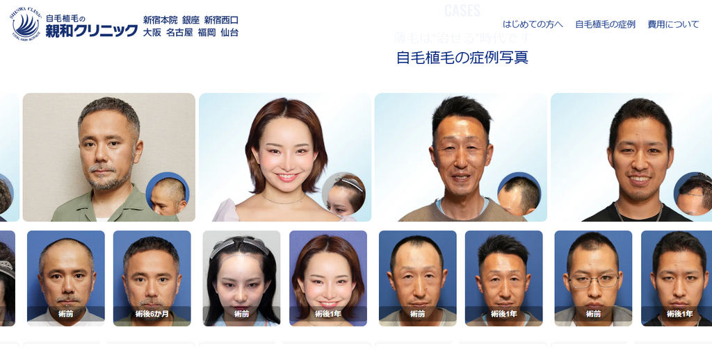 親和クリニック女性の薄毛治療